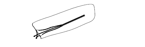 Μέρος Δ - Κάλυμμα Βροχής